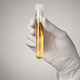 Illustration for article titled Human urine contains more than 3,000 distinct chemicals